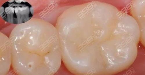 补牙视频成人版下载苹果